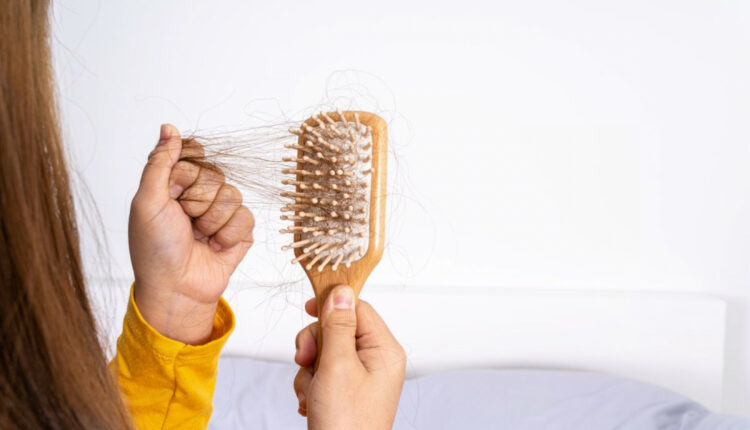 Tudo Sobre Cabelo Bonito Tudo Sobre Cabelos